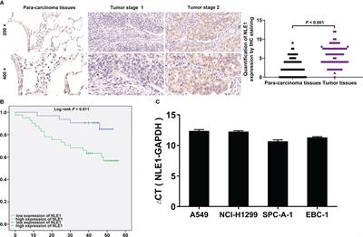 Identification of NLE1/CDK1 axis as key regulator in the development and progression of non-small cell lung cancer